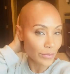 Jada Pinkett Smith Provides Fans an Update on Her Hair Loss