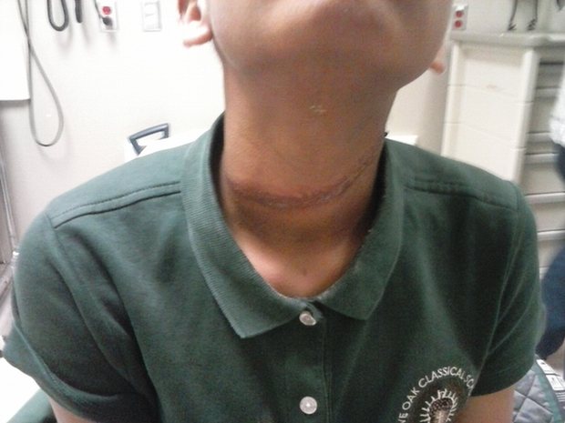 Black Parents File Lawsuit After White Schoolboys Drag Their Daughter by Neck With Rope