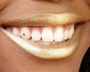 Oral Fixation: Get Familiar With The Latest Trend In Dental Jewelry