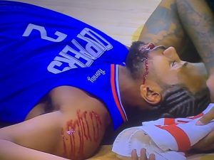 Kawhi Leonard Receives 8 Stitches in Christmas Day Game